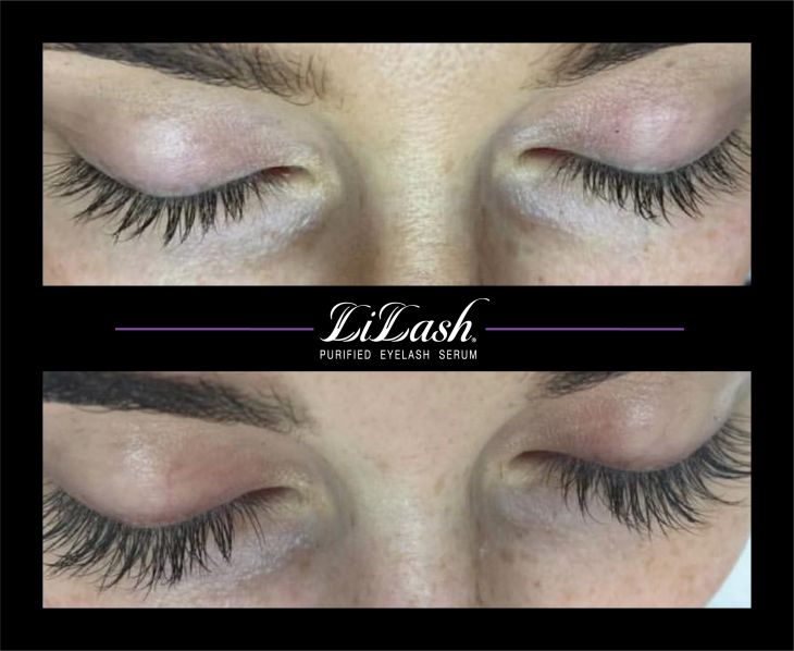 LiLash Purified Eyelash Serum - before and after