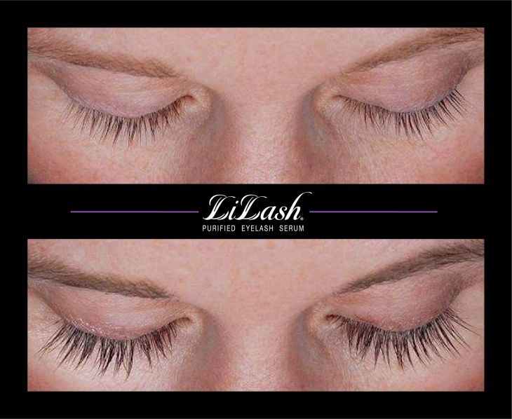 LiLash Purified Eyelash Serum - before and after